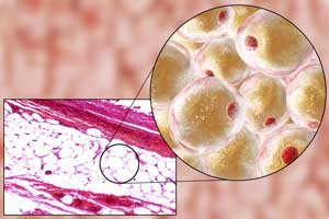 fat cells in you body
